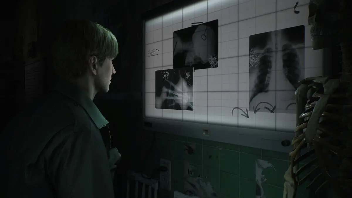 Silent Hill 2 Remake – Data de LANÇAMENTO é revelada